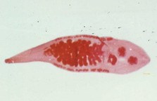 Nghiên cứu thực trạng nhiễm sán lá gan nhỏ ở một số tỉnh miền Trung Việt Nam